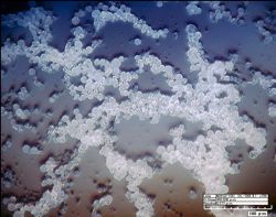 A photomicrograph of PHA microbeads created at VIMS. Scale is  in microns (millionths of a meter). Photo courtesy of Jason McDevitt, Applied Research Center.